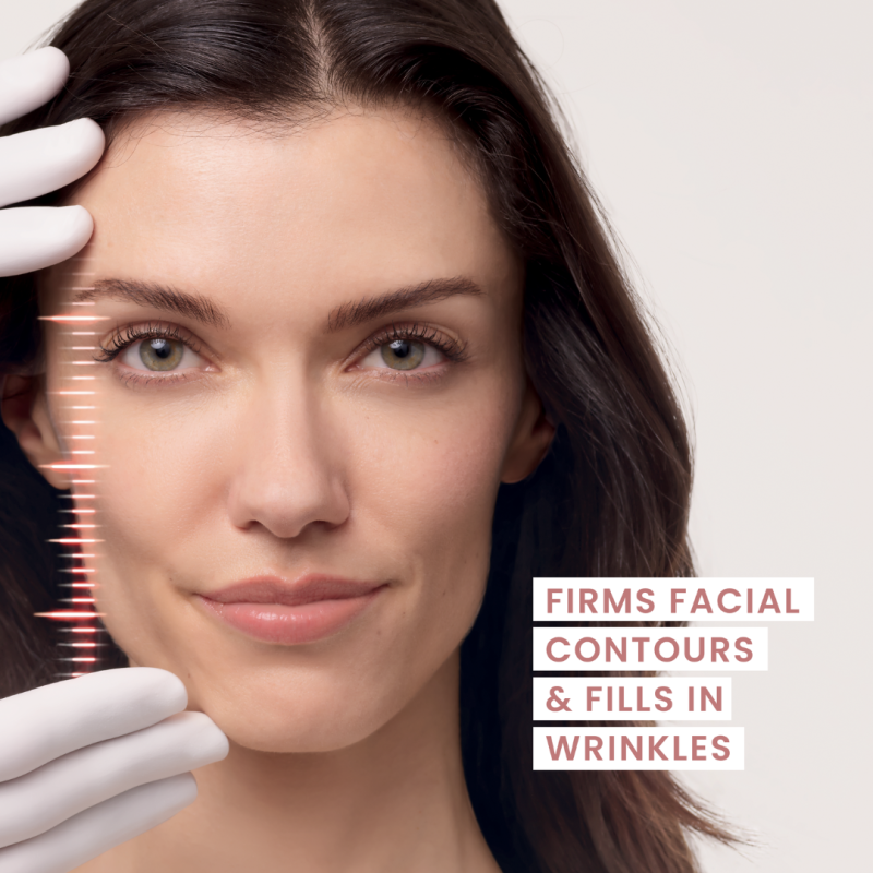 Avène Hyaluron Activ Micro-Lift Eye & Lip Cream l 0.05% Retinal 3x more active than retinol