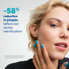 4_28.png Ducray Keracnyl Serum - Adult Blemish-Prone Skin