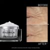 FilorgaNCEF-REVITALIZEEYES-Results_2.jpg Filorga NCEF Revitalize Eyes