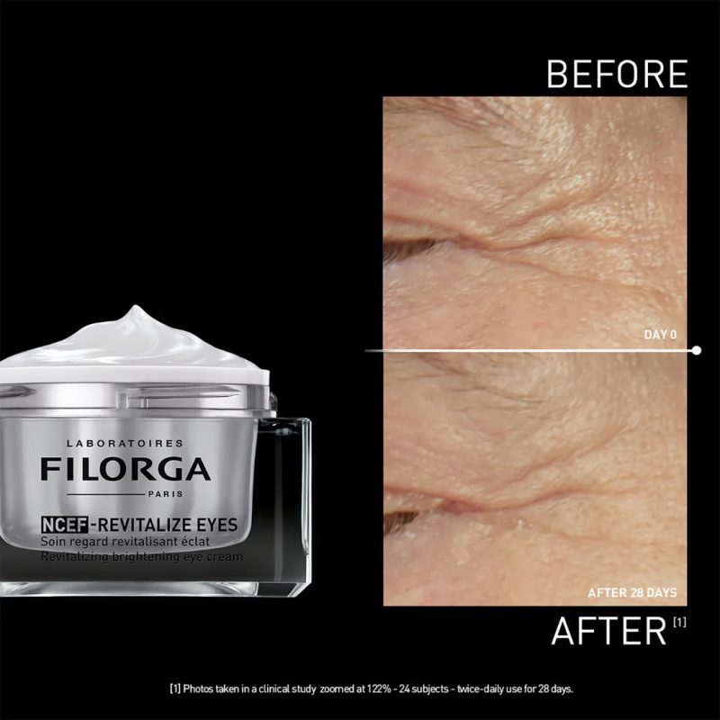 FilorgaNCEF-REVITALIZEEYES-Results_2.jpg Filorga NCEF Revitalize Eyes